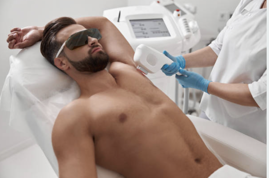 Láser y fotodepilación Hombre zonas M