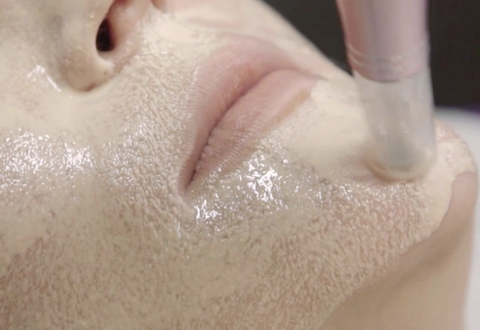 Facial, ultrasuoni, peeling, dermapen, collagene e fototerapia